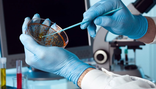Resistance to antibiotics costs 100 trillion by 2050